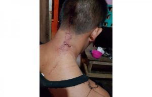 AGREDEN A DIRIGENTE INDÍGENA